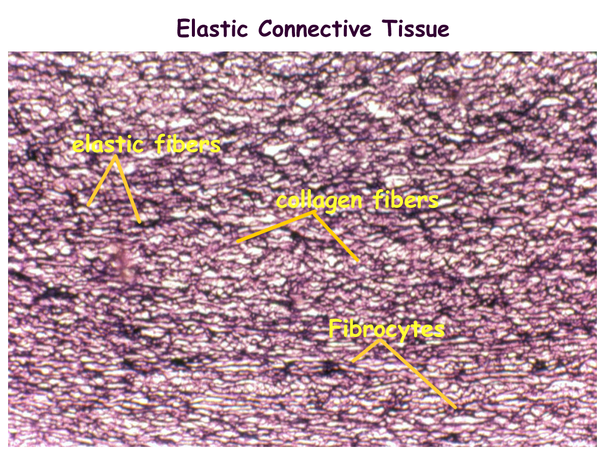cartilage tissue labeled